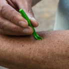 removing tick from arm